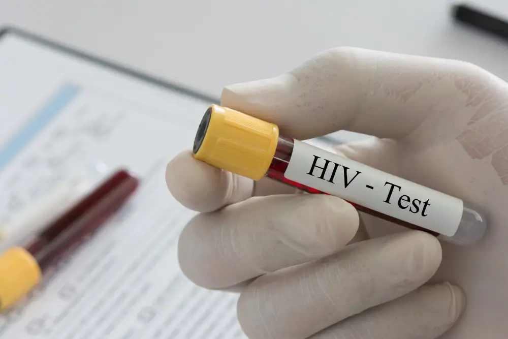 Immunodeficiency