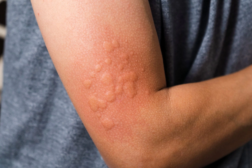 Expert Care for Skin & Allergic Conditions